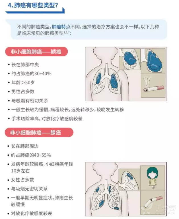 肺癌诊疗指南最新版概览与应用解析